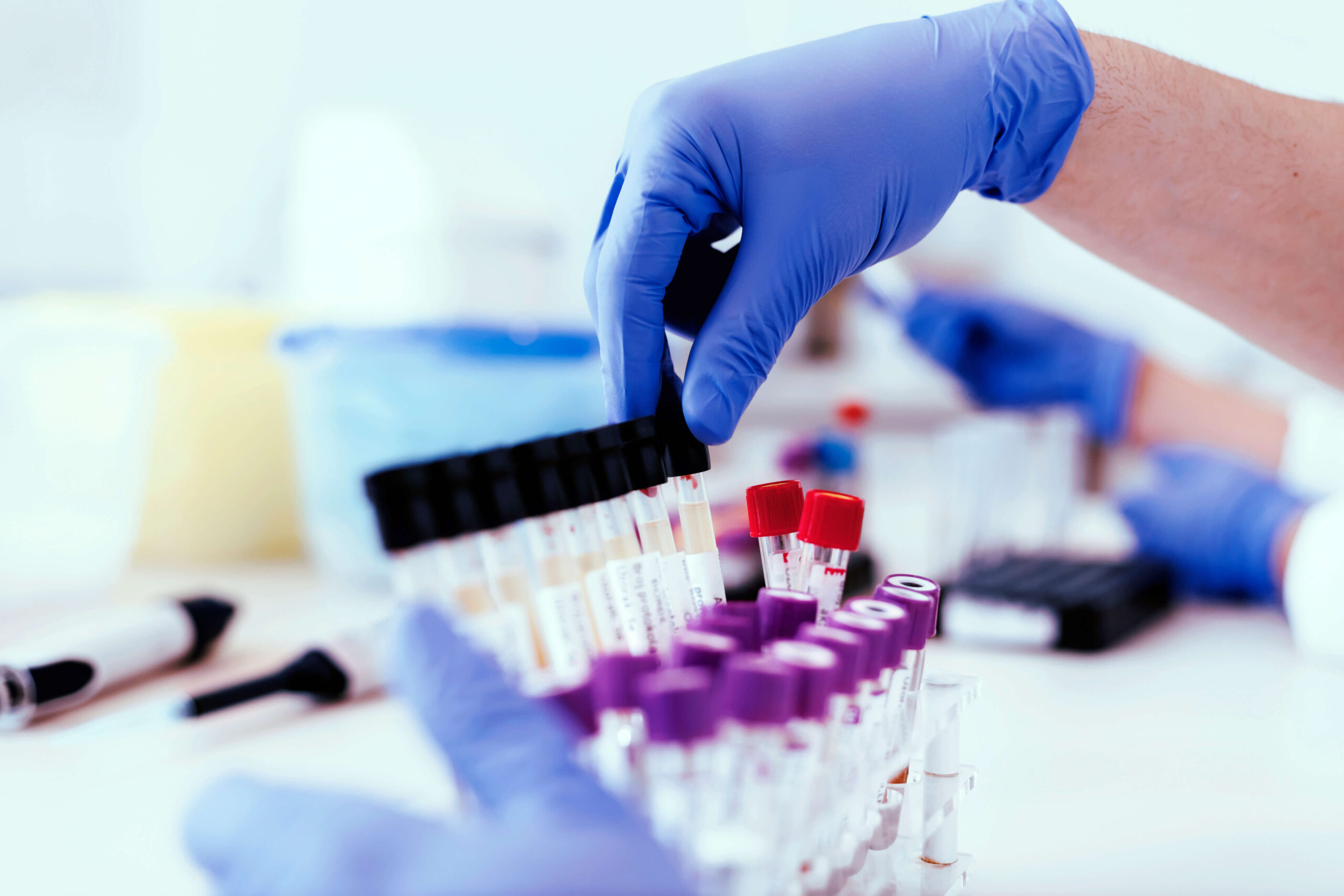 Medical person with blue gloves handling vials.